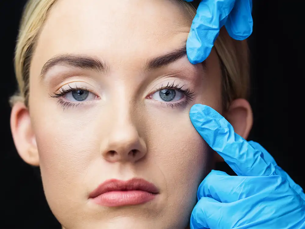Fox Eyes Surgery