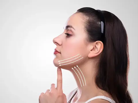 Gıdı Estetiği (Liposuction)