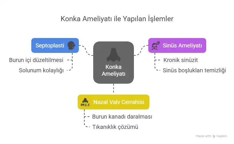 Konka ameliyatı ile yapılan işlemler