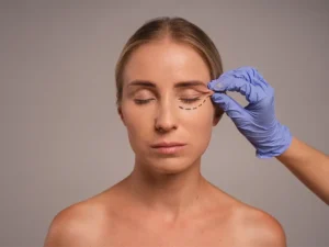 Fox Eyes Surgery